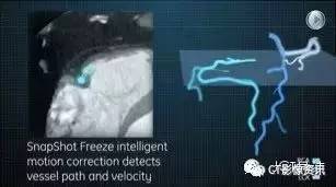 Smart Textiles:The Revolutionizing Power of Temperature-Responsive Fabrics