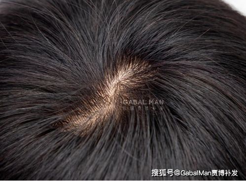 假发与纺织品的关系，假发属于纺织品一探究竟