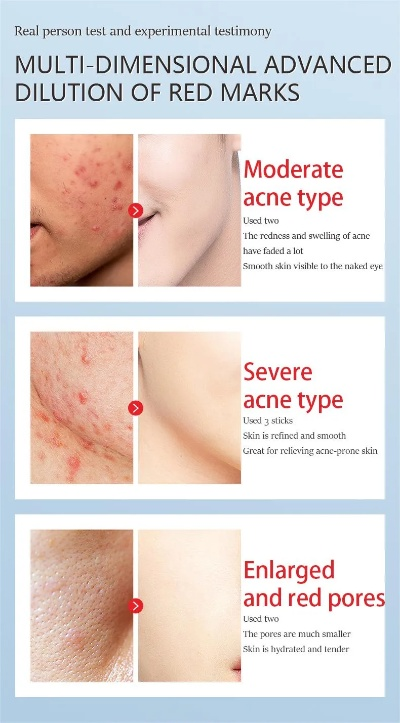 Textile Skincare and Healthcare Finishing Program
