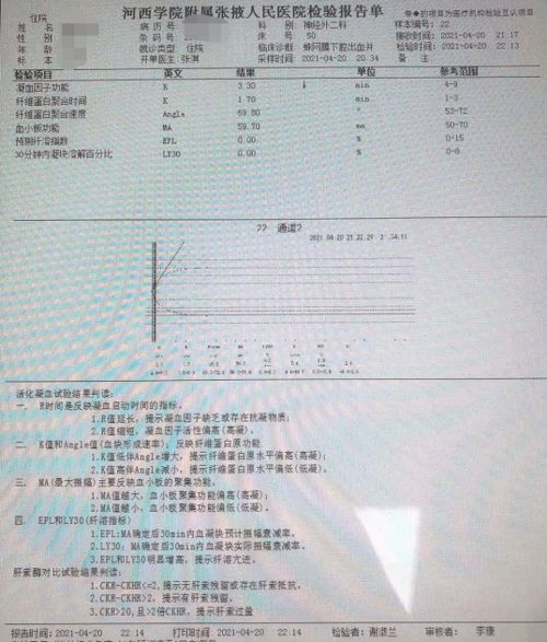 纺织品mts检测，全面解析与案例分析