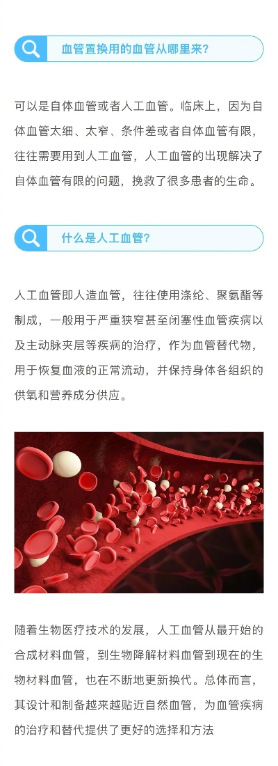 人造血管纺织品材料研究与应用案例