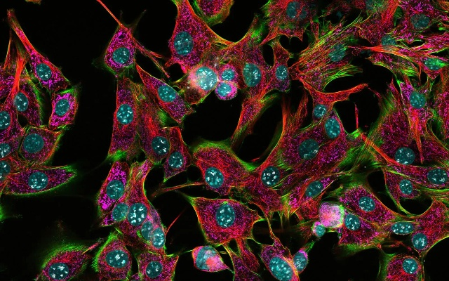 The Microscopes Eye View of Textiles