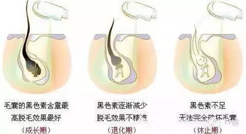 纺织品脱毛标准与案例分析