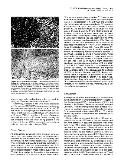 The Impact of Carcinogenic Dyes in Textiles:A Comprehensive Assessment