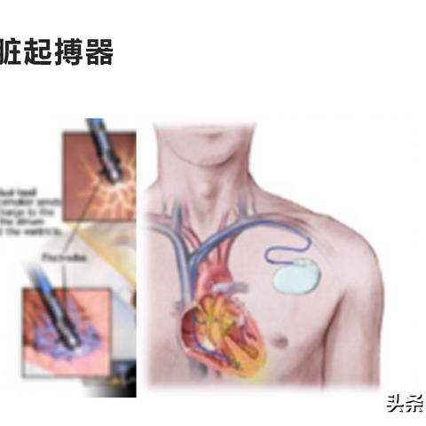 纺织品天然纤维介绍图