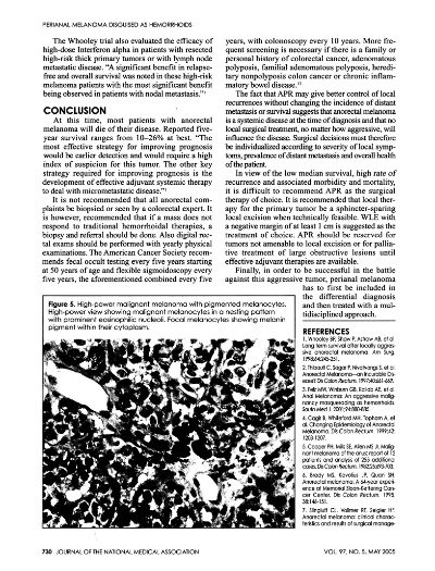 The Role of High-Manganese Perchlorate in Textile Treatments