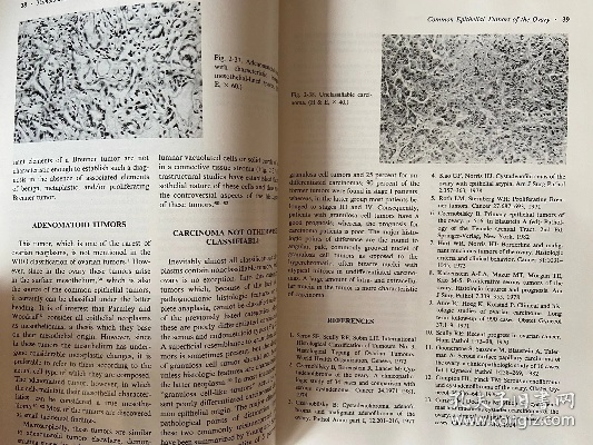 The Evolution of Textiles:A Journey Through the Two-Word Fabrication